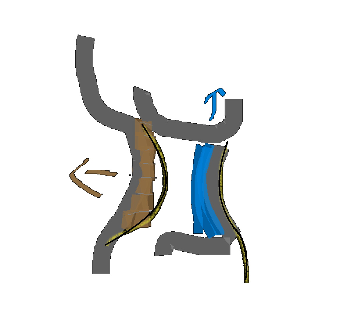 Lordosis cervical tratamiento natural